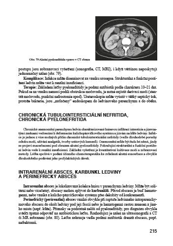 Infekční nemoci ve standardní a intenzivní péči