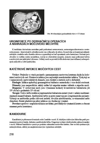 Infekční nemoci ve standardní a intenzivní péči