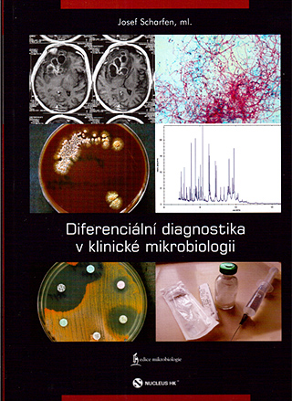 Josef Scharfen, ml.: Diferenciální diagnostika v klinické mikrobiologii, Nucleus 2013