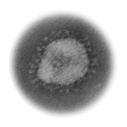 Elektronmikroskopický obraz koronaviru